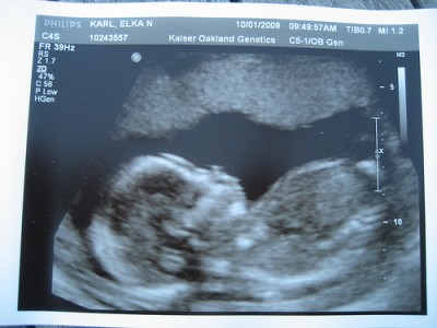 We can't wait to meet him.