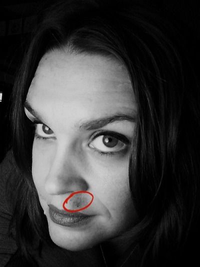 Yep, that's a birth mark.