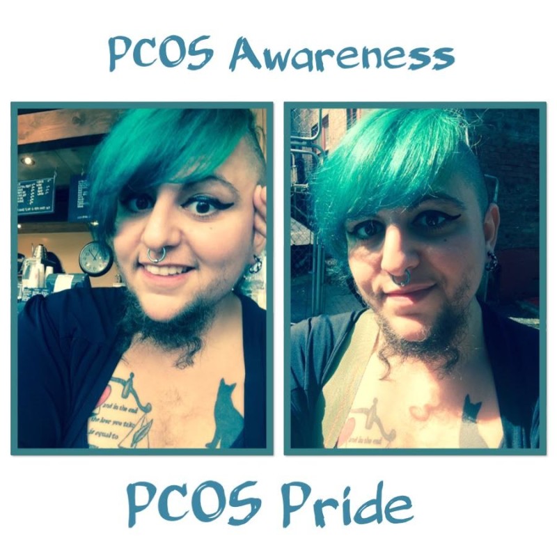 Polycystic Ovarian Syndrome Awareness
